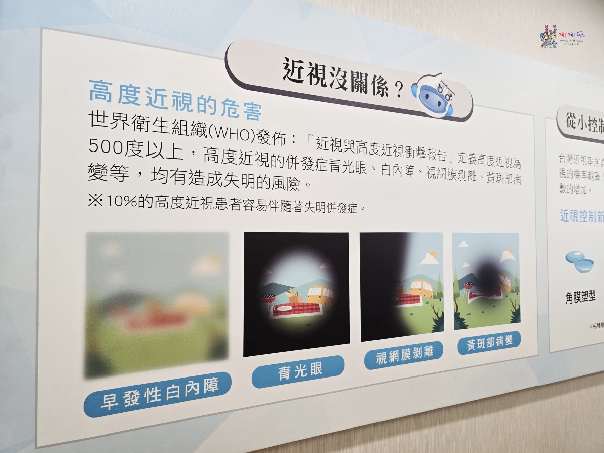 學童近視矯正新科技《大學眼鏡‧大學眼科》周邊離焦鏡片讓小孩輕鬆穩定好視力! - 第4張圖